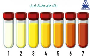 ارتباط بین رنگ ادرار و بیماری های درونی